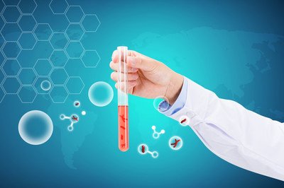 做试管还是选择人工受孕？圣晨医疗说说人工受孕的特点