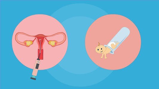 高龄女性做试管有哪些促排方案？圣晨医疗分析一下