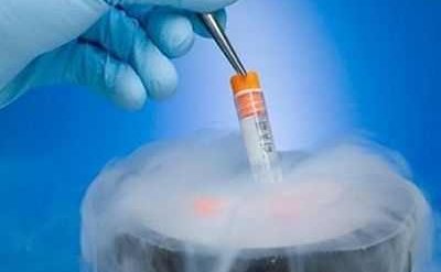 哪些人做试管的时候需要养囊？满足什么条件？