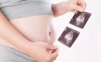 试管受孕成功后有哪些注意事项？孕妈妈要做什么