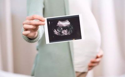 到杭州做试管可以做哪些准备？怀孕成功要怎么做？